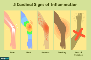 sings of inflammation